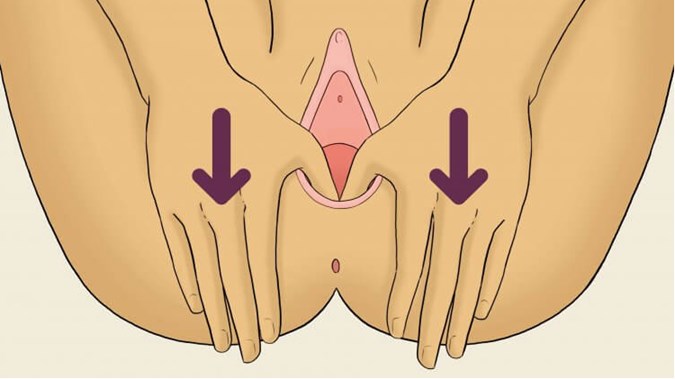 Perineal Massage Prevent Tearing