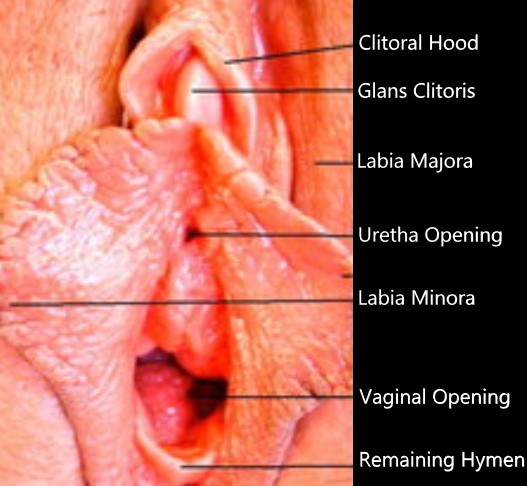 Clitoral Phimosis Adhesion Release